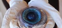 Picture Mystery Of Giant Eyeball That Puzzled Marine Biologists In Florida Solved