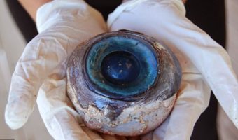 Picture Mystery Of Giant Eyeball That Puzzled Marine Biologists In Florida Solved