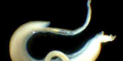 Picture This Mysterious Living Creature Found in 6200-Year-Old Tomb Links Technology To Spread Of Disease