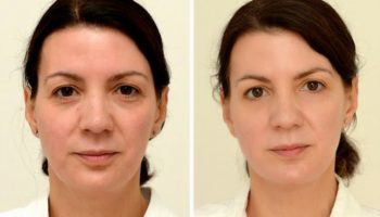 Picture This Woman Drinks 3 Litres Of Water Every Day And The Results Are Shocking!