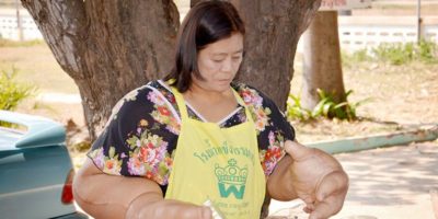 Picture This Woman Has The World’s Largest Hands And They Weigh A Stone And A Half Each