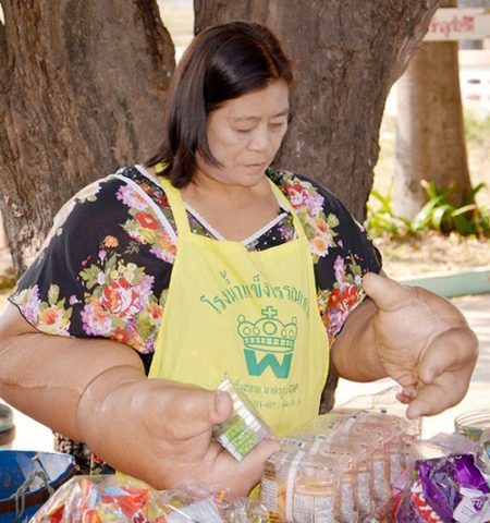 Picture This Woman Has The World’s Largest Hands And They Weigh A Stone And A Half Each