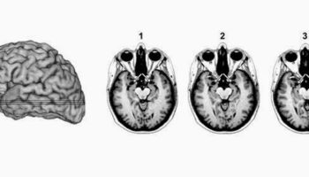 Picture According To Science, You Will Be Fearless If You Remove This Part Of Your Brain