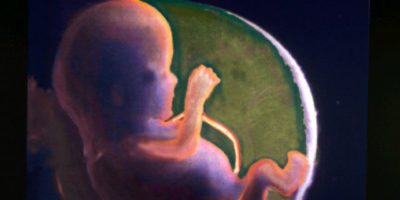 Picture Extraordinary Facts About Human Body Functions Everyone Should Know!