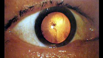 Picture 12 Most Disturbing Photos With Their Terrifying Backstories!