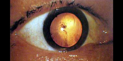 Picture 12 Most Disturbing Photos With Their Terrifying Backstories!