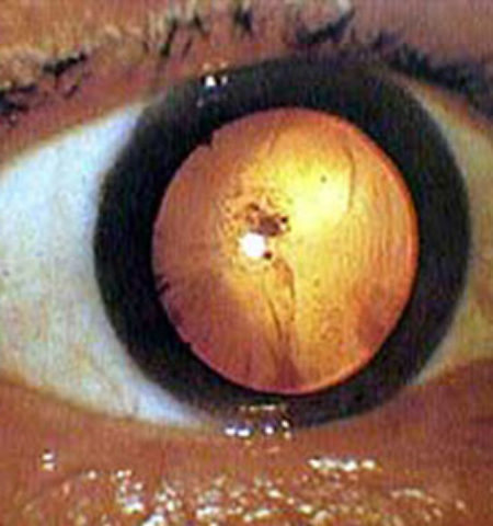 Picture 12 Most Disturbing Photos With Their Terrifying Backstories!