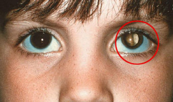 Picture 15 Incredible Life-Saving Facts That Everyone Should Know!