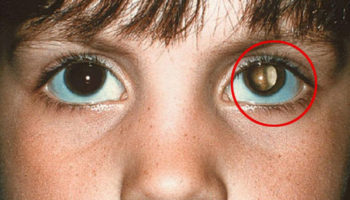 Picture 15 Incredible Life-Saving Facts That Everyone Should Know!