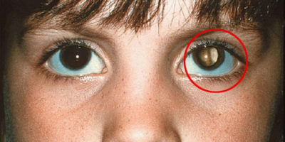 Picture 15 Incredible Life-Saving Facts That Everyone Should Know!