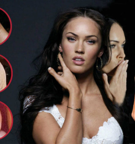 Picture These 19 Seemingly Perfect Celebrities With Physical Imperfections Will Astound You