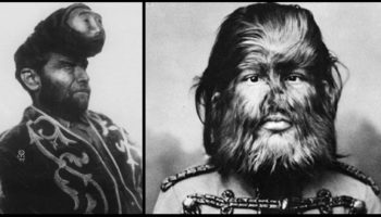 Picture 10 Unbelievable Vintage Circus Freaks Who’ll Give You Goosebumps