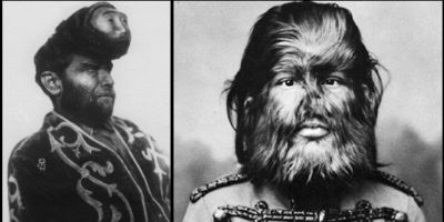 Picture 10 Unbelievable Vintage Circus Freaks Who’ll Give You Goosebumps