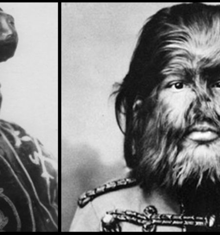 Picture 10 Unbelievable Vintage Circus Freaks Who’ll Give You Goosebumps