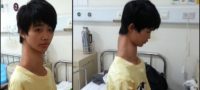 Picture This Chinese Kid With An Unusually Long Neck Is Suffering From Rare Spinal Deformity