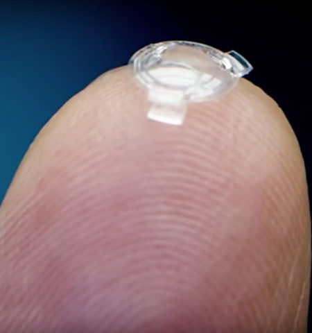 Picture This Bionic Lens Implant may improve your Vision Three Times over for Your Entire Lifetime