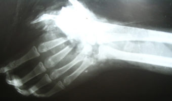 Picture 15 Interesting Facts About Left-handed People that Show How They are Different Right-handers