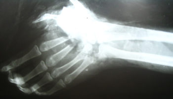 Picture 15 Interesting Facts About Left-handed People that Show How They are Different Right-handers