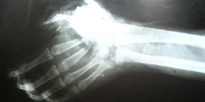 Picture 15 Interesting Facts About Left-handed People that Show How They are Different Right-handers