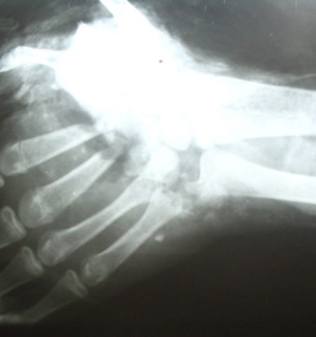 Picture 15 Interesting Facts About Left-handed People that Show How They are Different Right-handers