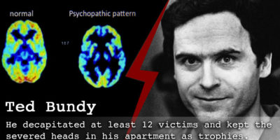 Picture Psychological and Neurological studies explain what motivates Serial Killers to Murder
