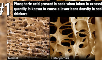 Picture 15 Disturbing Facts About Soda You Really Need To Know