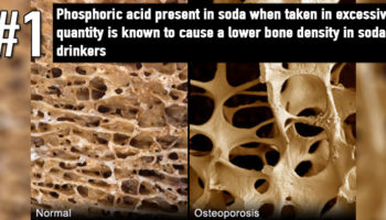 Picture 15 Disturbing Facts About Soda You Really Need To Know
