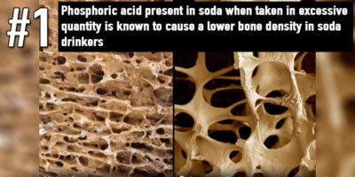 Picture 15 Disturbing Facts About Soda You Really Need To Know