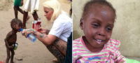 Picture Heartbreaking pictures of a two year old slowly dying from starvation is saved by a Danish woman