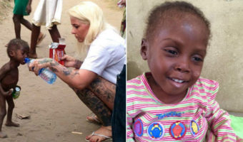 Picture Heartbreaking pictures of a two year old slowly dying from starvation is saved by a Danish woman