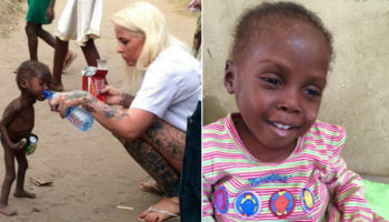 Picture Heartbreaking pictures of a two year old slowly dying from starvation is saved by a Danish woman