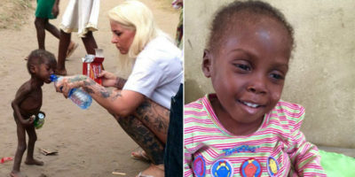 Picture Heartbreaking pictures of a two year old slowly dying from starvation is saved by a Danish woman