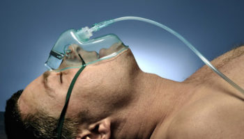 Picture Project ReAnima: Brain-Dead People Could Be Brought Back To Life In Groundbreaking Medical Trial