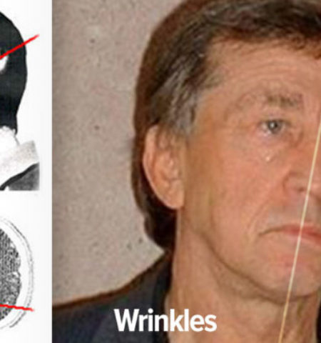 Picture The Two Faced Man: Particle Accelerator Keeps One Half Of A Man’s Face Young & Wrinkle Free