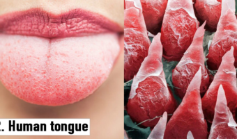 Picture 20 Things That Look Absolutely Bizarre Under a Microscope