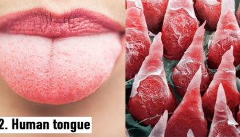 Picture 20 Things That Look Absolutely Bizarre Under a Microscope