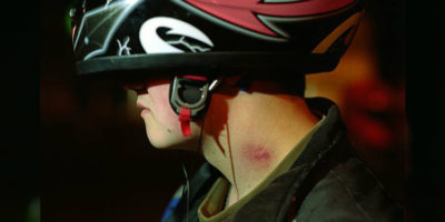 Picture A Mexican Teen Dies After Receiving a Love Bite From His Girlfriend