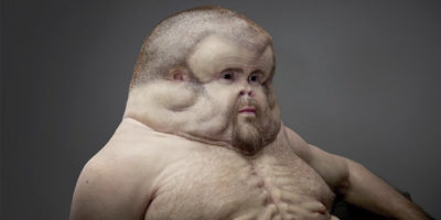 Picture Meet Graham – The Super Human With Massive Head & Extra Nipples, One Who Can Survive High Speed Car Crash