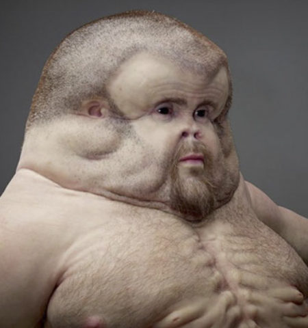 Picture Meet Graham – The Super Human With Massive Head & Extra Nipples, One Who Can Survive High Speed Car Crash