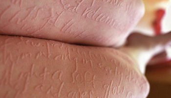 Picture 18 Strange Medical Conditions That Sound Unreal