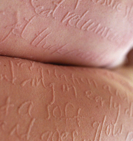 Picture 18 Strange Medical Conditions That Sound Unreal