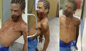 Picture Terrifying Footage Shows “Possessed” Man In Hospital With Bullet Wound On Face