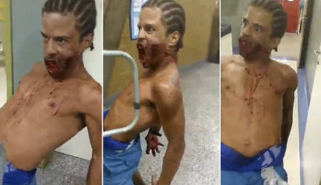 Picture Terrifying Footage Shows “Possessed” Man In Hospital With Bullet Wound On Face