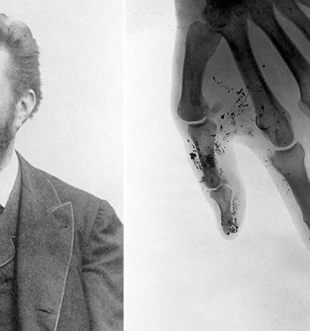 Picture 10 Things That Were Discovered Accidentally