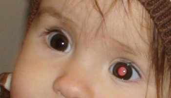 Picture 10 Trivial Facts That Might One Day Save Your Life