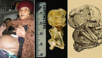 Picture 11 Spooky Facts That Are Deeply Unsettling