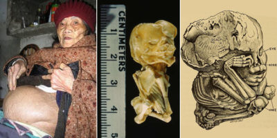 Picture 11 Spooky Facts That Are Deeply Unsettling