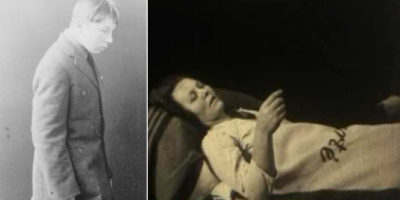 Picture Encephalitis lethargica: The mysterious plague from 1916 that plunged people into decades-long slumber