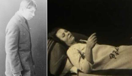 Picture Encephalitis lethargica: The mysterious plague from 1916 that plunged people into decades-long slumber