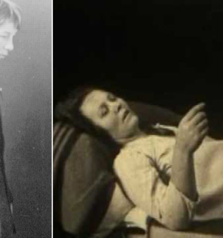Picture Encephalitis lethargica: The mysterious plague from 1916 that plunged people into decades-long slumber